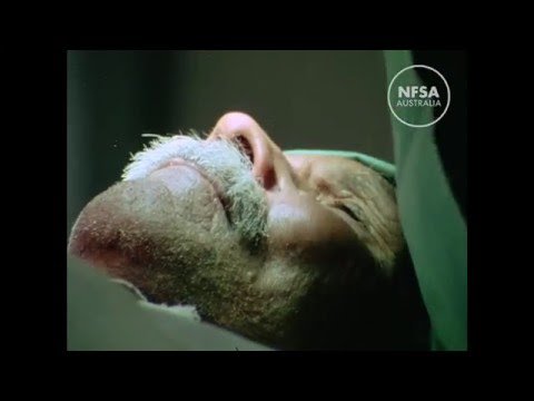 They used to call it sandy blight thumbnail image.