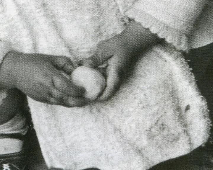 A still image from Turner's Syndrome : trials and triumphs