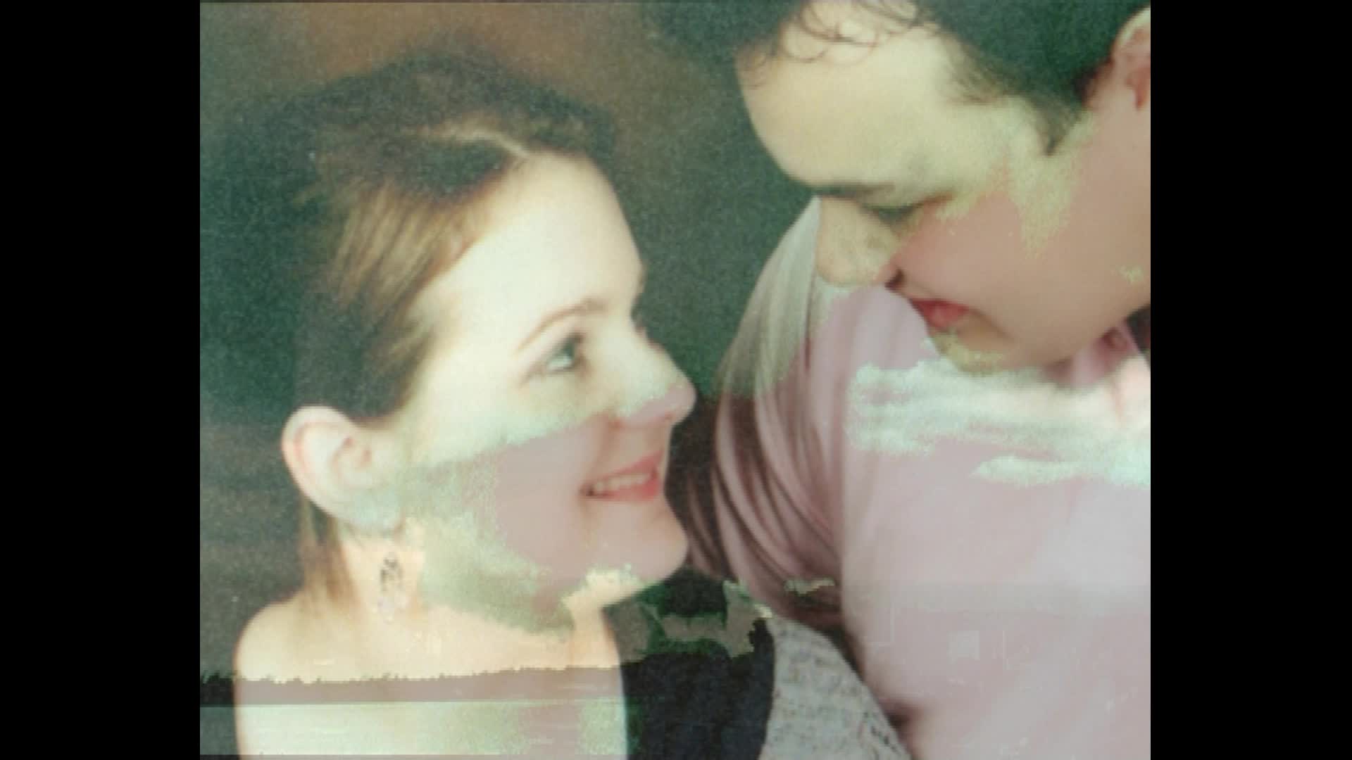 My Scar thumbnail image.