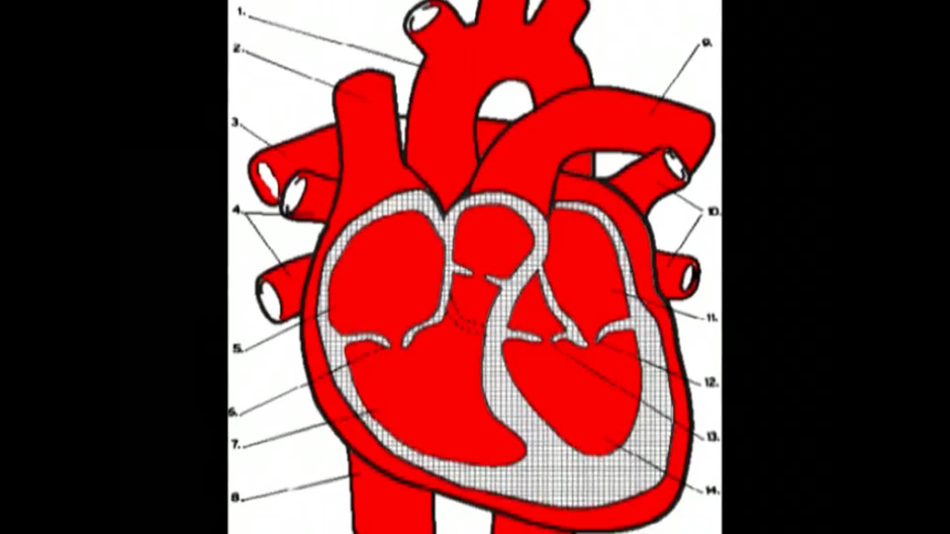 Heart disease thumbnail image.