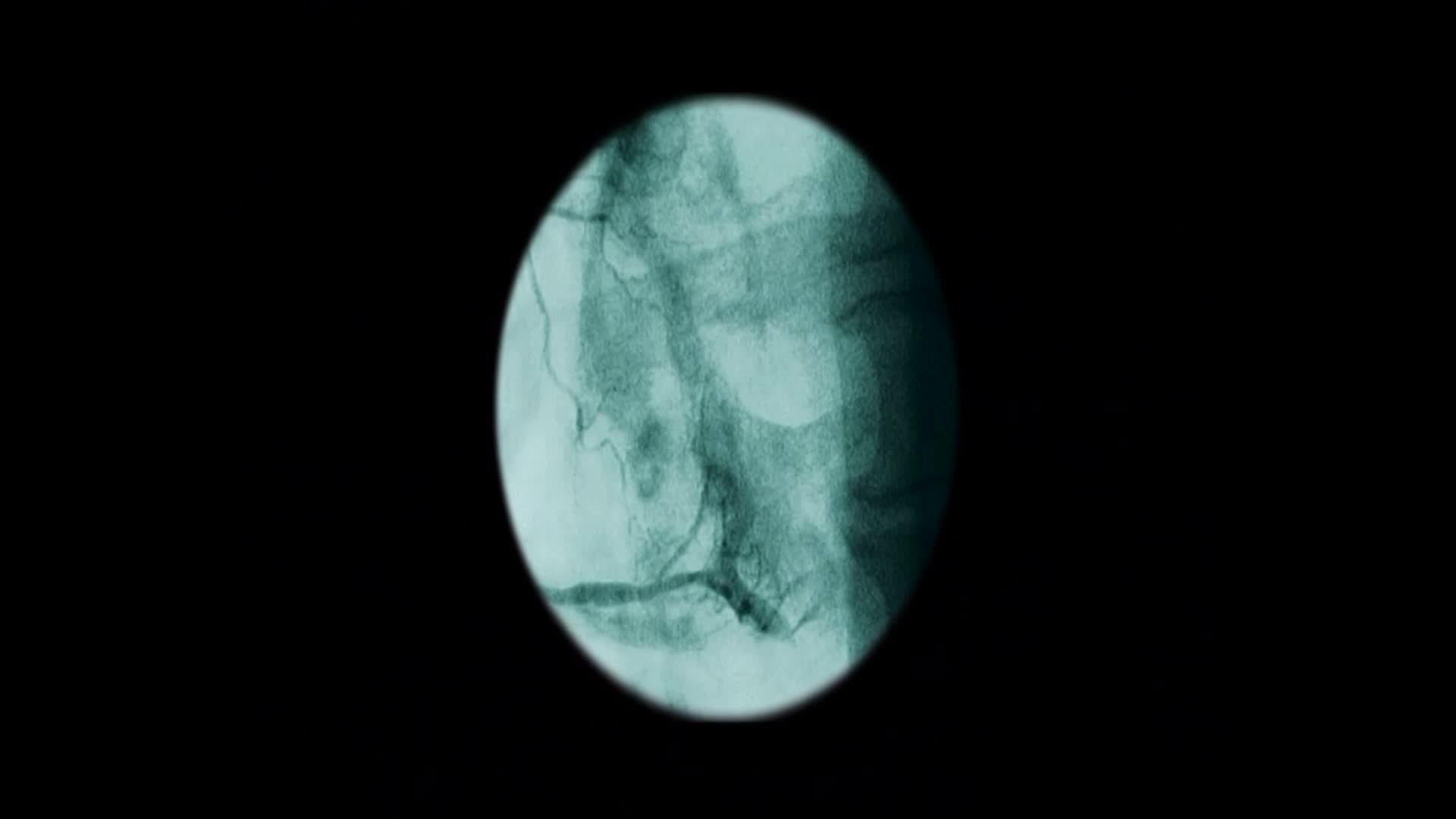 From the heart thumbnail image.