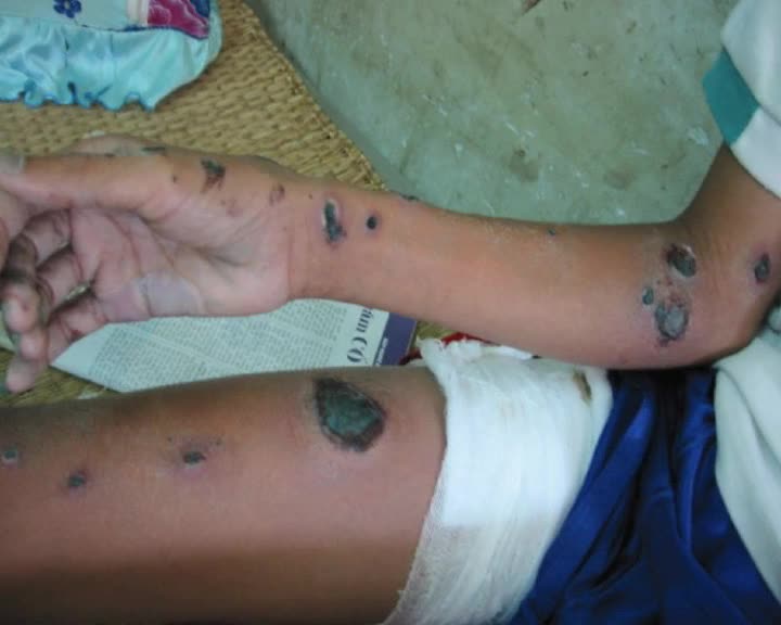 Rwanda thumbnail image.